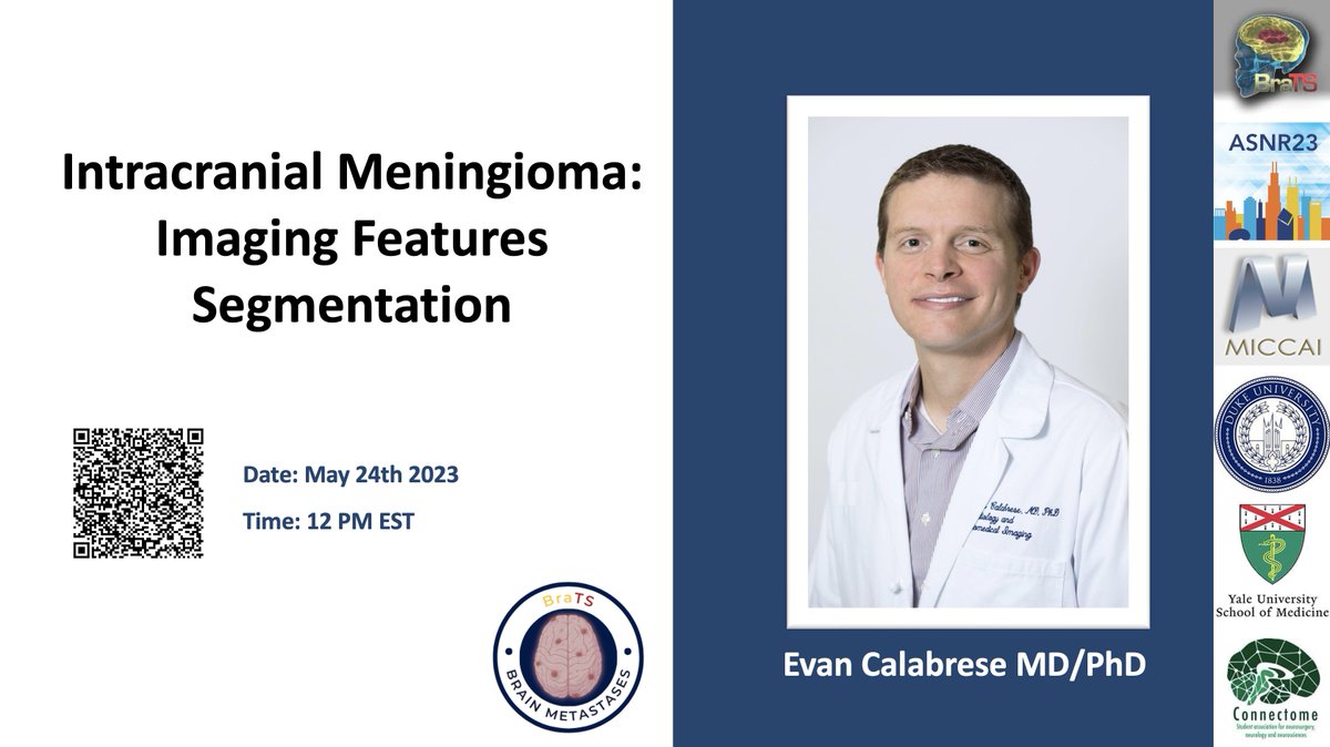 Anastasia Janas (@anastasiajanas) on Twitter photo Wait, isn't it a #meningioma? đź‘€
You are absolutely right! Eager to learn more about these tumors and their imaging traits? Join our tomorrow's must-attend session with the brilliant <a href="/ecalabr/">Evan Calabrese, MD PhD</a> and unravel the mysteries of meningioma. Don't miss out‼️ Wait, isn't it a #meningioma? 👀
You are absolutely right! Eager to learn more about these tumors and their imaging traits? Join our tomorrow's must-attend session with the brilliant <a href="/ecalabr/">Evan Calabrese, MD PhD</a> and unravel the mysteries of meningioma. Don't miss out‼️