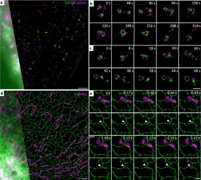 manorlaboratory's tweet photo. Lovely results here! 
"Single-frame deep-learning super-resolution microscopy for intracellular dynamics imaging" https://t.co/PcxXDllE1m