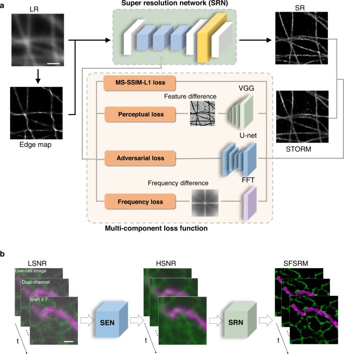 manorlaboratory's tweet photo. Lovely results here! 
"Single-frame deep-learning super-resolution microscopy for intracellular dynamics imaging" https://t.co/PcxXDllE1m