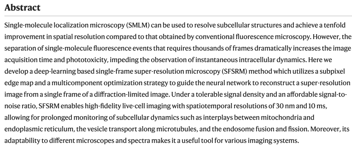 manorlaboratory's tweet photo. Lovely results here! 
"Single-frame deep-learning super-resolution microscopy for intracellular dynamics imaging" https://t.co/PcxXDllE1m