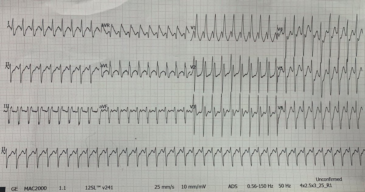 ECGs tweet media