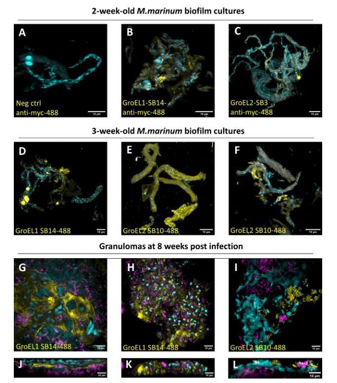 In #mSystems, researchers demonstrate the potential of surface proteomic strategies to identify nanobody-binding targets on mycobacterial biofilms. The results highlight the potential of using biofilm-targeting nanobodies for therapeutic purposes. asm.social/1dW