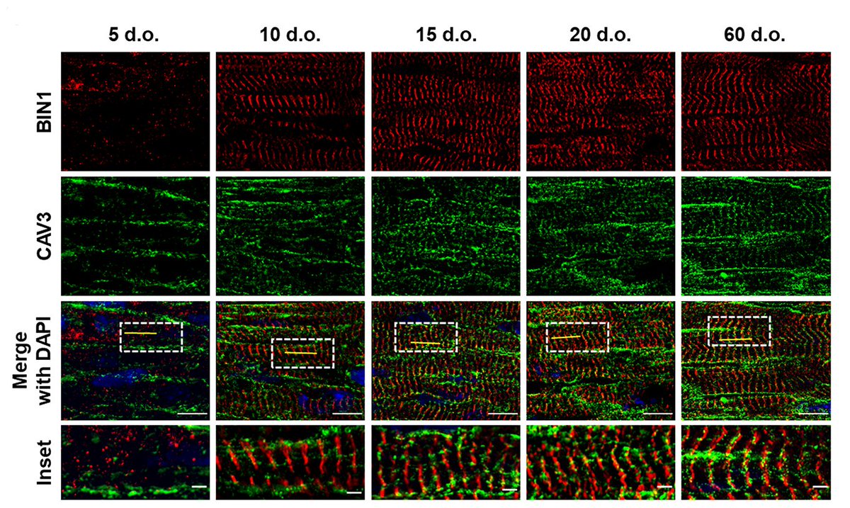 CircRes's tweet photo. Perdreau-Dahl & colleagues demonstrate that #t-tubule growth in developing #cardiomyocytes is coordinated by 3 proteins working in tandem: #BIN1, #MTM1, and #DNM2. Learn more at https://t.co/u4nLBLnyBR
@IEMRLouch https://t.co/SSikeTj6O8