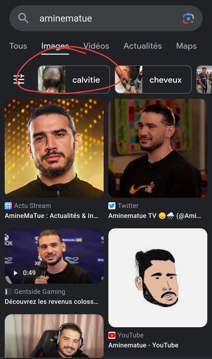 chanibba's tweet photo. @AmineMaTue c'est quoi encore cette singerie ???? https://t.co/cJENhrbU7W