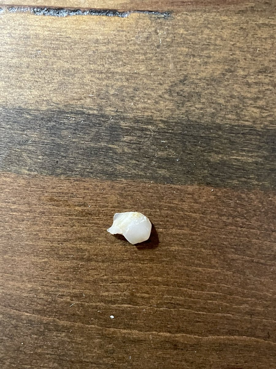 IamDkitty's tweet photo. @SourPunchCandy just had your sour apple flavor.  But into it and this broken tooth was inside it.  I checked my mouth and it’s not one of my teeth.  Should I call my attorney? https://t.co/WMrXt4rLJz