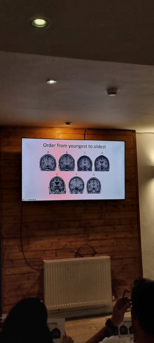 Our first interval activity...can you get the order right? #mri #ageing