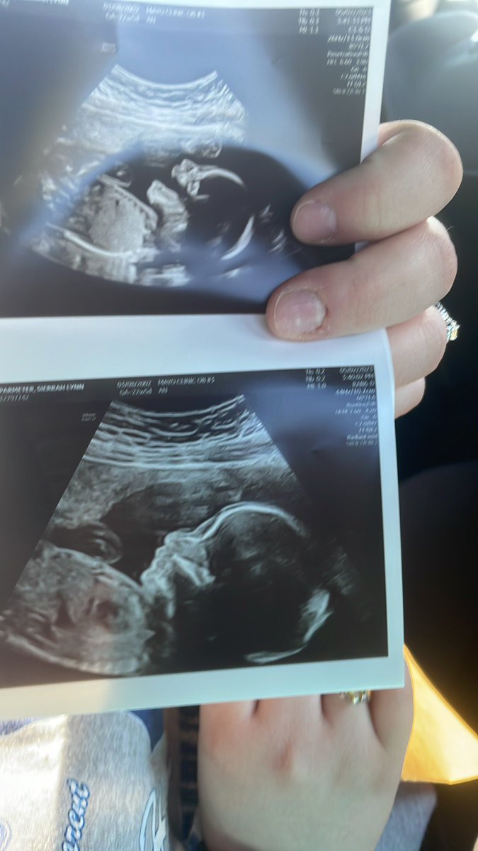 NSOPTIC's tweet photo. Less the 3 months till baby girl comes!! Can’t wait https://t.co/SDxvO0OLIK