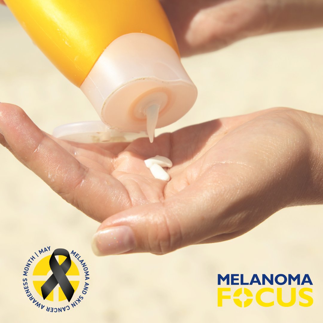 Melanoma Focus UK (@focusonmelanoma) on Twitter photo 📣 Today we’ll be joining our Patron Sir Chris Bryant MP (<a href="/RhonddaBryant/">Chris Bryant</a>) & <a href="/AmyCallaghanSNP/">Amy Callaghan</a> for a parliamentary event with clinicians & patients to raise even more awareness about #MelanomaAwarenessMonth & our recent research supporting Amy's #VATburn campaign. 📣 Today we’ll be joining our Patron Sir Chris Bryant MP (<a href="/RhonddaBryant/">Chris Bryant</a>) & <a href="/AmyCallaghanSNP/">Amy Callaghan</a> for a parliamentary event with clinicians & patients to raise even more awareness about #MelanomaAwarenessMonth & our recent research supporting Amy's #VATburn campaign.