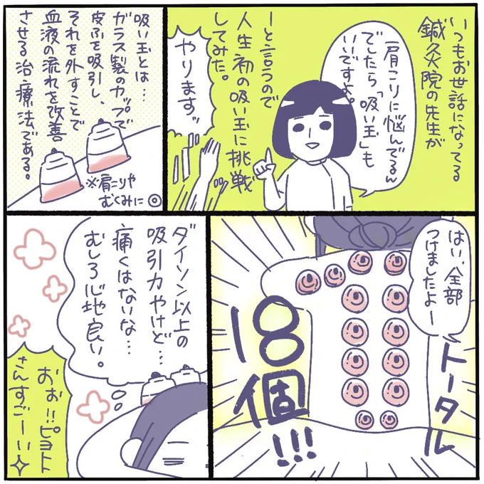 吸い玉してきました。 背中の開いたドレスが着れません(着ない)  #ピヨトト家 #育児マンガ #鍼灸院