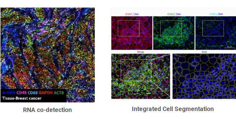 Join us for a webinar with Roberto Spada on Tuesday, May 30! Learn how the Hyperion XTi™, integrated #cellsegmentation, batch slide staining and storage, and protein and RNA co-detection capabilities can help you uncover the secrets of #spatialbiology.
my.demio.com/ref/LhSwSkQNsL…