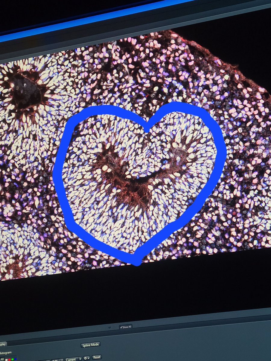 A little late night love from our organoids to you 💕