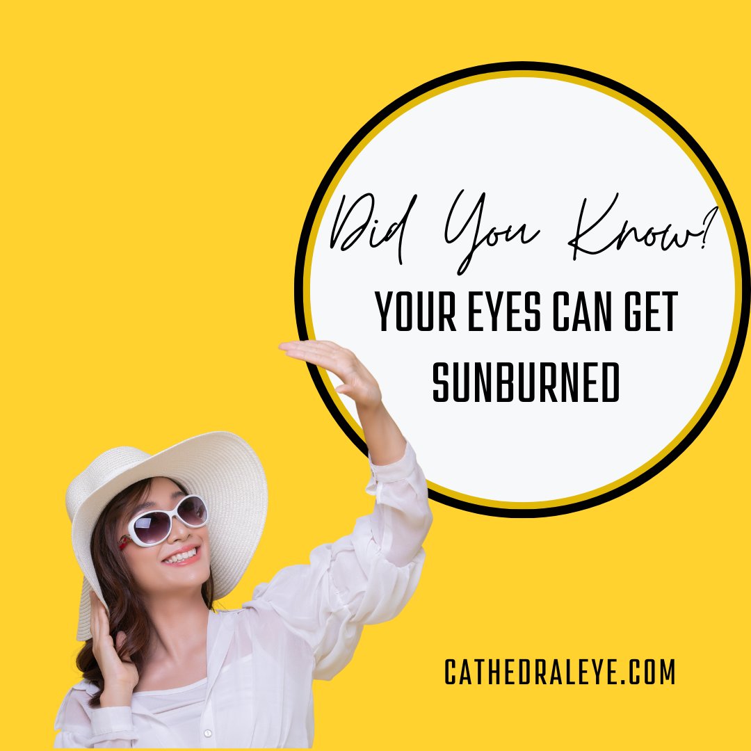 Did you know... Your eyes can get sunburned🕶☀️ cathedraleye.com