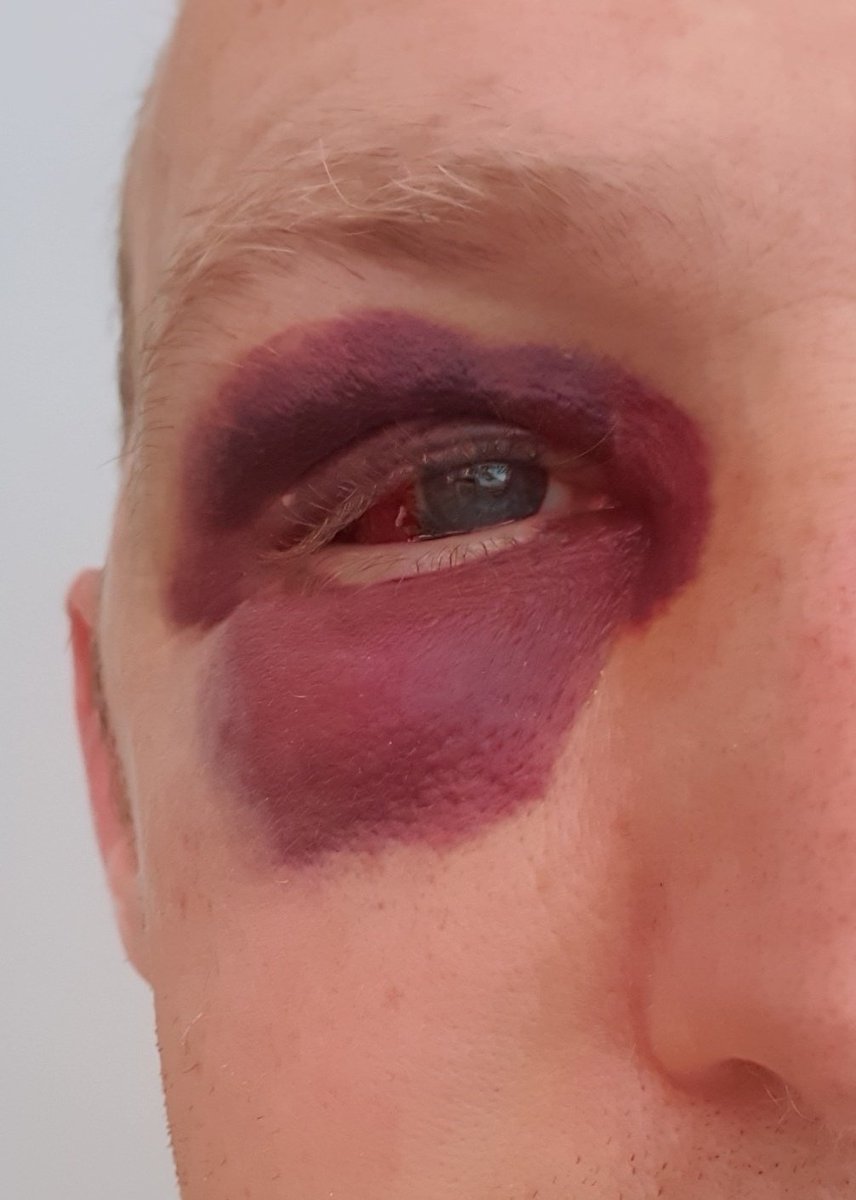 Dr Alan Watson tweet media