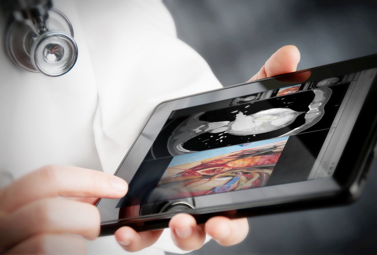 rh_shah07's tweet photo. Cardiovascular Information System (CVIS) Market Size, Top Players, Trends in Upcoming Years

For Getting More Insights:- https://t.co/IFVkUwRRuN
#cardio #cardiovascular #information #systems #systems #market #cvis #Cardiology #medical https://t.co/g1azWdw7Z4