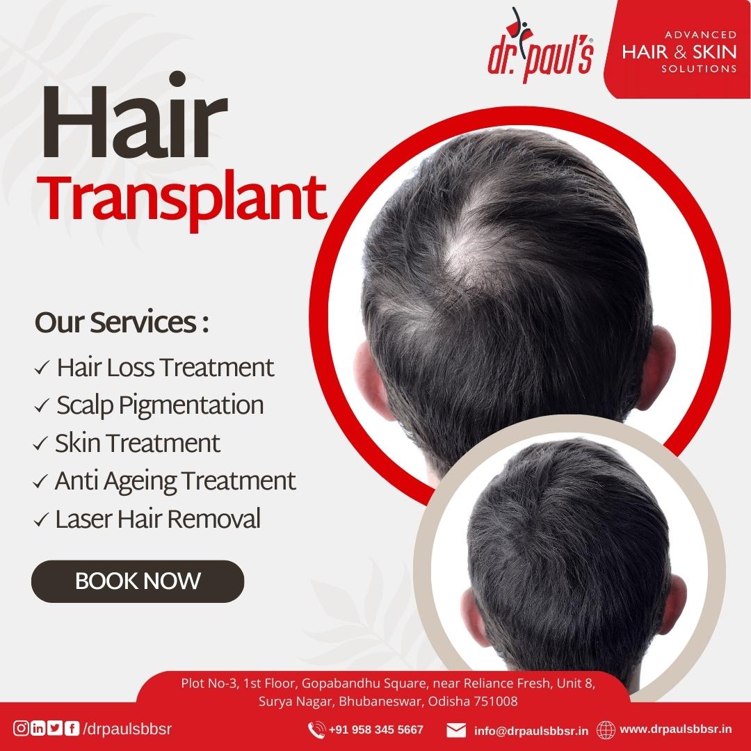 drpaulbbsr_'s tweet image. Our exceptional hair transplant clinic offers a permanent solution to hair loss. Embrace your natural beauty and let your hair shine! 
For more detail: 095834 55667
Email: drpaulbbsr@gmail.com
#HairTransplant #hairgoals #healthyhair #haircare #drpaul #hairtreatment #hairclinic