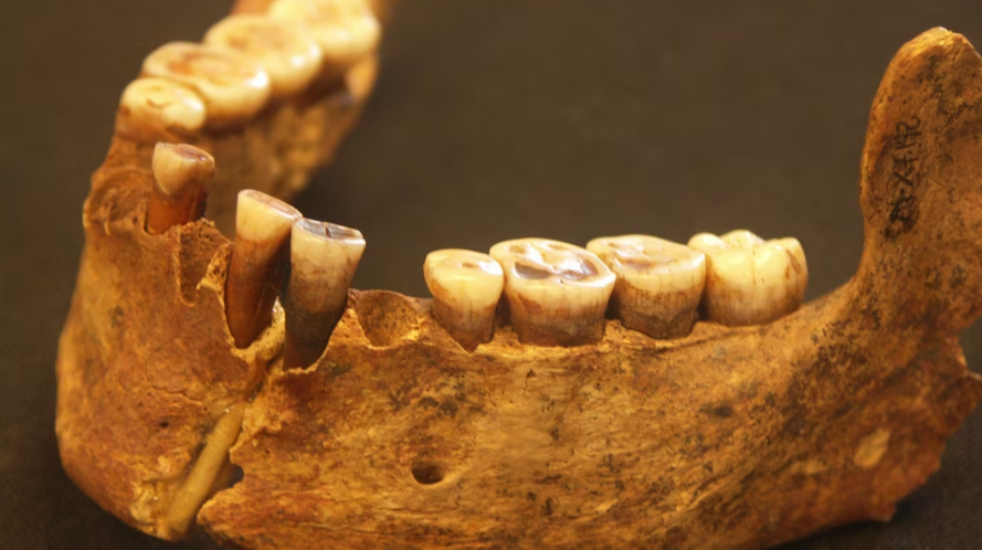 Questa è la dentatura della Dama Rossa di El Mirón, donna vissuta circa 19.000 anni fa e ritrovata in Spagna: sul suo tartaro sono stati trovati batteri preistorici. E potrebbero aiutarci a creare nuovi antibiotici...
focus.it/scienza/scienz…