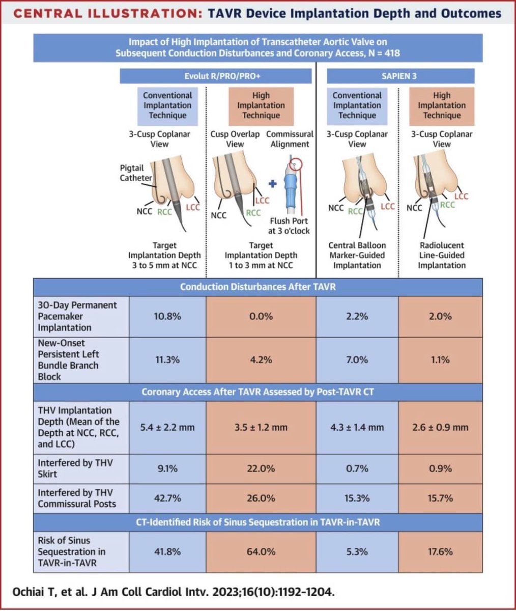 Our paper on impact of high implantation of transcatheter aortic valve on subsequent conduction disturbances and coronary access is online @JACCJournals #JACCINT jacc.org/doi/10.1016/j.… Thanks to all co-authors and great editrial @dmylotte