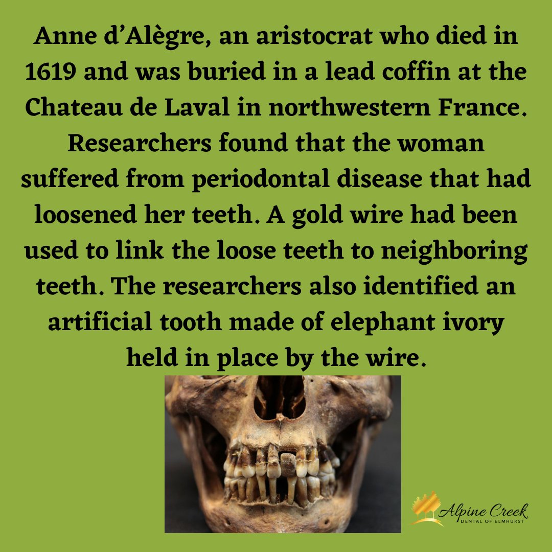 Archaeologists Discover 17th-Century French Aristocrat Used Dental Prosthetics, straight teeth have always been in fashion!

-Journal of Archaeological Science

#NowYouKnow #SupportLocal #StandWithSmall #WholeBodyHealth #ElmhurstDentist #ElmhurstFamilyDentist #AlpineCreekDental
