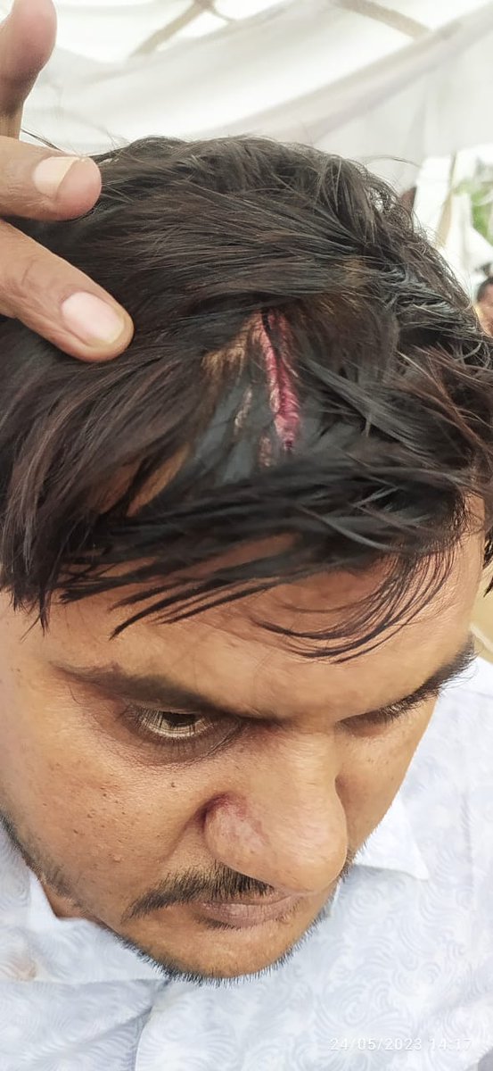 indian_0308's tweet photo. @INCIndia @SarveshSWM @RahulGandhi ये चल क्या रहा हैं राजस्थान में इधर भी देख लो 
क्या आज कोई अंतर बचा हैं @BJP4India और @INCIndia में
@RajCMO @ashokgehlot51 @ABPNews https://t.co/YhJ5QTNCmB