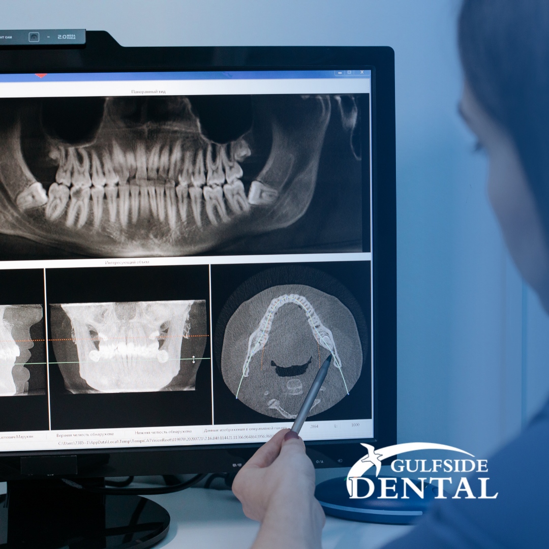 Get a clear picture of your oral health with advanced dental X-ray technology. Schedule your dental X-ray with us!  

#gulfsidedental #dental #dentist #naples #naplesdentist #dentalcare #like #instalike #follow #instafollow #teeth #smile #cosmeticdentist #dentures #dentalim...