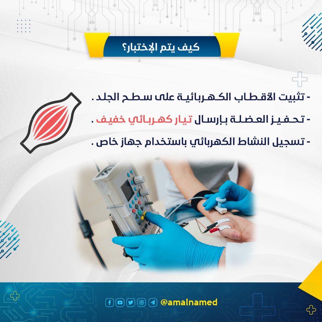 amalnamed's tweet photo. تخطيط كهربية العضلات⚡️
.
.
.
.
#تخطيط_العضلات #عضلات #electromyography #emg #electromyogram #هندسة_طبية #طب_الأعصاب #العضلات #الهندسة_الطبية #هندسة_طبية_حيوية #amalnamedical⚙️ #biomedical #biomedical_engineering #biomedicalengineering https://t.co/6GVki5SIPs