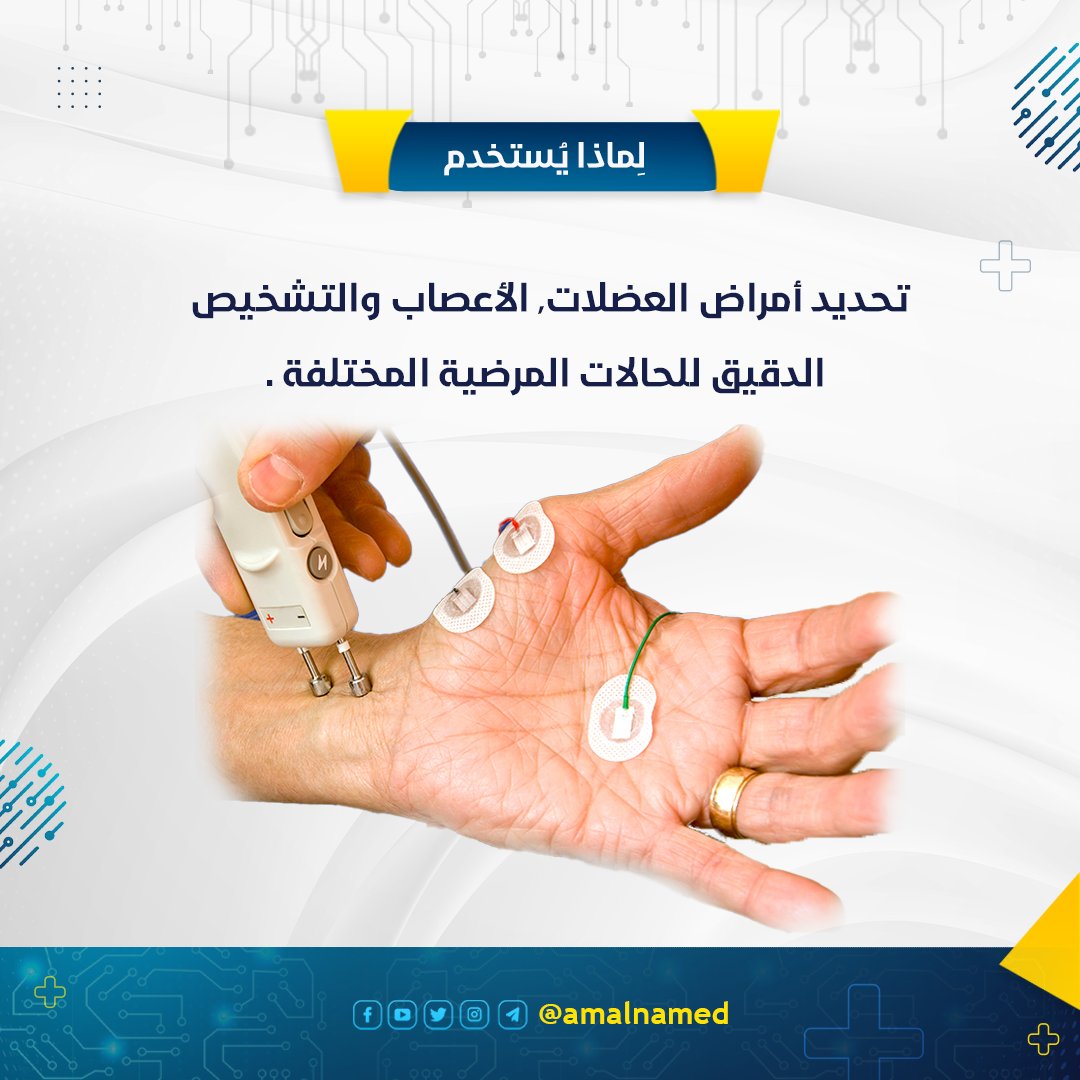 amalnamed's tweet photo. تخطيط كهربية العضلات⚡️
.
.
.
.
#تخطيط_العضلات #عضلات #electromyography #emg #electromyogram #هندسة_طبية #طب_الأعصاب #العضلات #الهندسة_الطبية #هندسة_طبية_حيوية #amalnamedical⚙️ #biomedical #biomedical_engineering #biomedicalengineering https://t.co/6GVki5SIPs