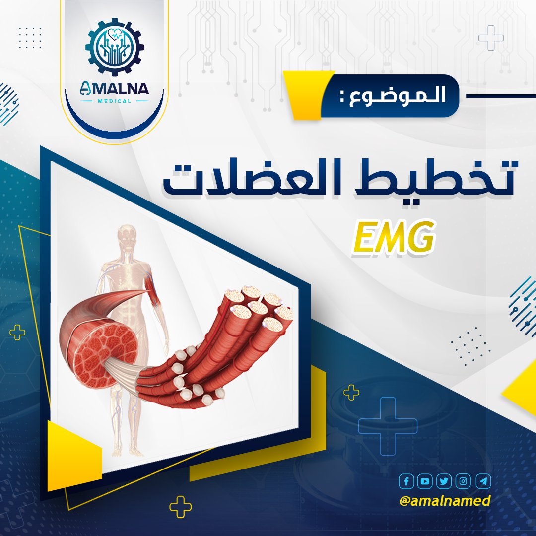 amalnamed's tweet photo. تخطيط كهربية العضلات⚡️
.
.
.
.
#تخطيط_العضلات #عضلات #electromyography #emg #electromyogram #هندسة_طبية #طب_الأعصاب #العضلات #الهندسة_الطبية #هندسة_طبية_حيوية #amalnamedical⚙️ #biomedical #biomedical_engineering #biomedicalengineering https://t.co/6GVki5SIPs