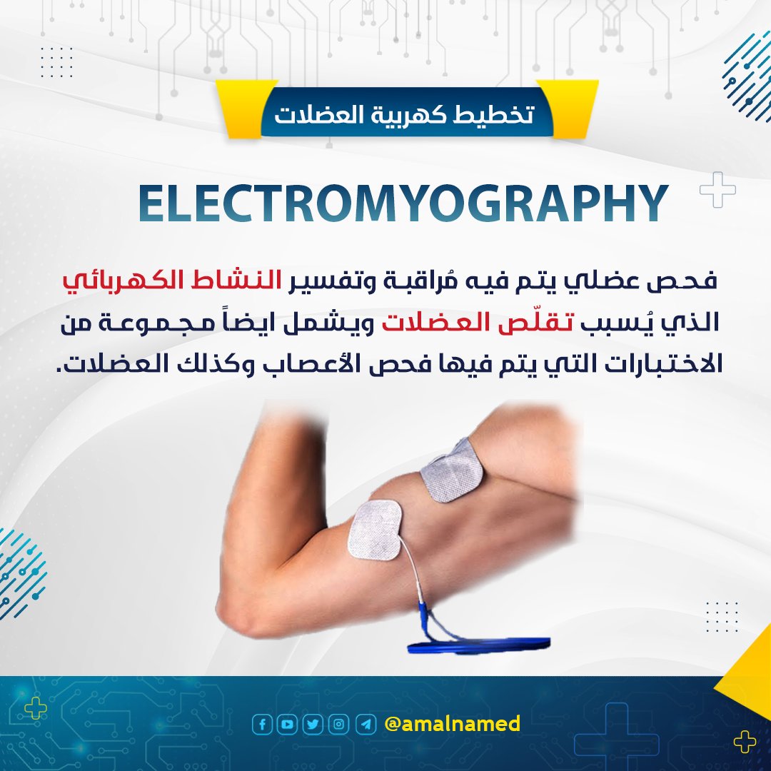 amalnamed's tweet photo. تخطيط كهربية العضلات⚡️
.
.
.
.
#تخطيط_العضلات #عضلات #electromyography #emg #electromyogram #هندسة_طبية #طب_الأعصاب #العضلات #الهندسة_الطبية #هندسة_طبية_حيوية #amalnamedical⚙️ #biomedical #biomedical_engineering #biomedicalengineering https://t.co/6GVki5SIPs