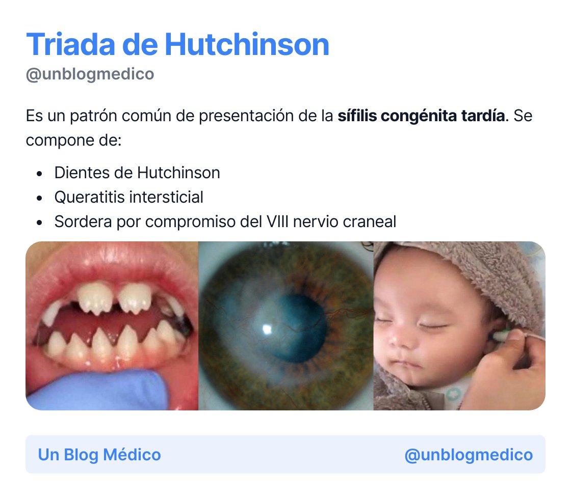 🏥 Triada de Hutchinson 🏥