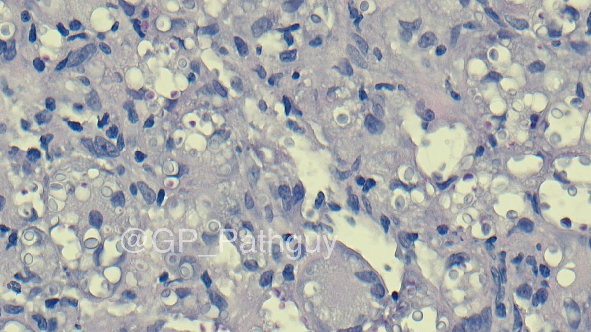 Glenn Murray tweet media