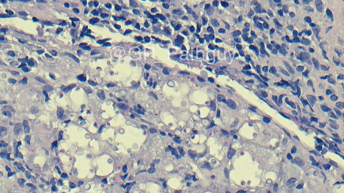 Glenn Murray tweet media