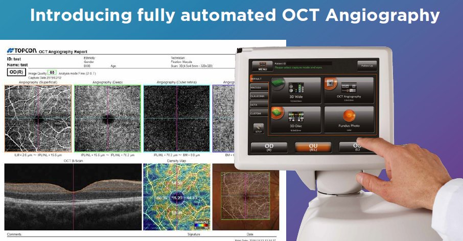 Looking for an #OCT? The #Maestro2 gives you true colour fundus imaging with fully automated #OCTAngiography. Single touch operation auto aligns, auto focuses and auto fires. Find out just how easy-to-use our Maestro2 OCT is. Stand H at RCO
#ophthalmology #RCOphthCongress23
