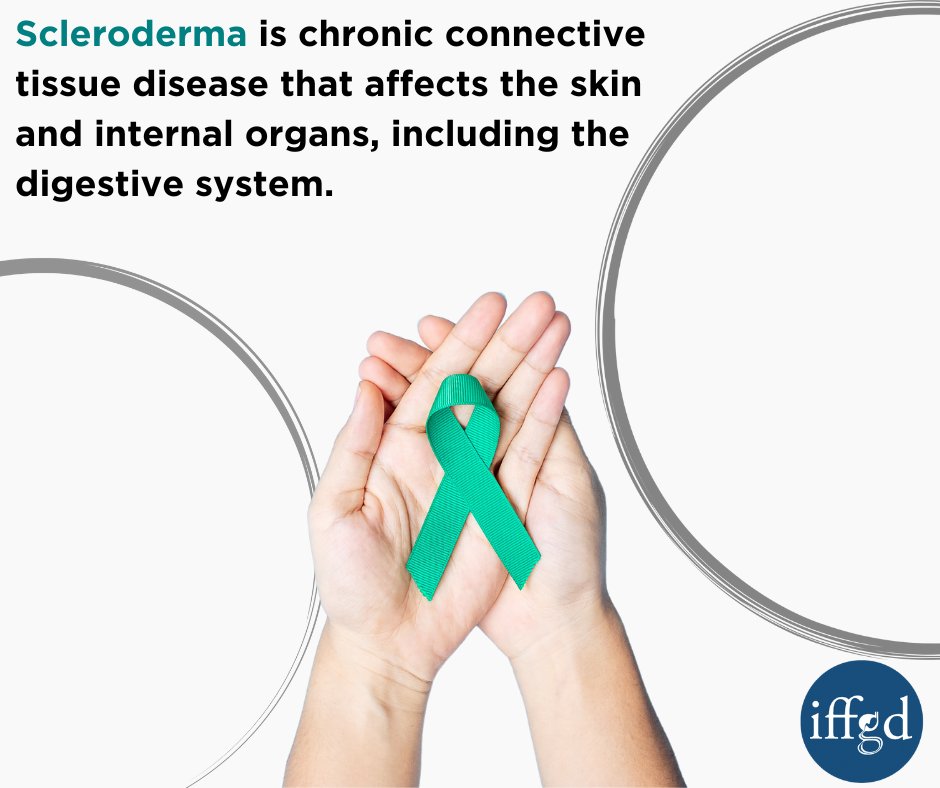 IFFGD's tweet image. It's #SclerodermaAwarenessMonth! Let's shine a light on this rare autoimmune disease that affects thousands of people worldwide. It also been shown to have effects on the #GItract. Click the link below to learn more:
iffgd.org/gi-disorders/s…
#DigestiveHealthMatters #GITwitter