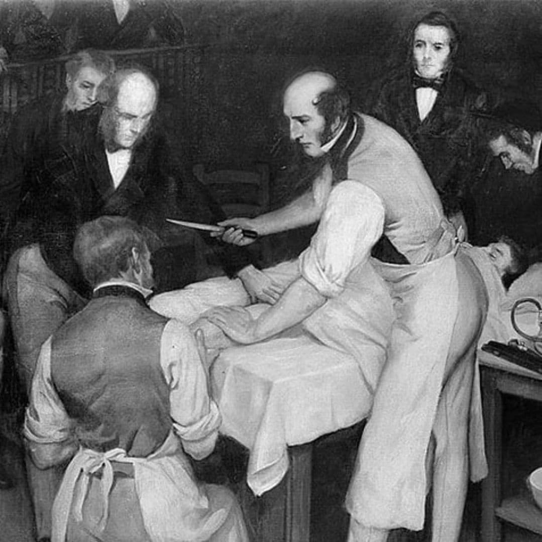 Robert Liston (1794-1847) was a Scottish surgeon who is most famous for amputating a patient's leg in under 2.5 minutes, operating so quickly that in the process also amputated the fingers of his assistant and slashed the coattails of a spectator, who dropped dead from sheer