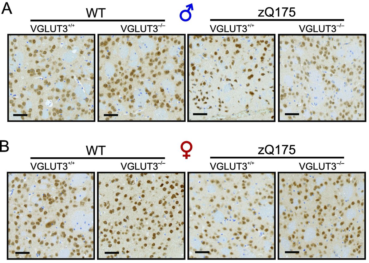 SfN Journals (@sfnjournals) on Twitter photo #JNeurosci: <a href="/Krm_Ib/">Karim Ibrahim</a> <a href="/elmestikawy/">sala</a> <a href="/K_S_Abdelrahman/">Khaled Abdelrahman</a> & <a href="/FergusonottawaS/">stephen ferguson</a> <a href="/LabFerguson/">Ferguson Lab (University of Ottawa)</a> <a href="/uOttawaBMRI/">uOBMRI</a> <a href="/OttawaCmm/">uOttawaCMM</a> showed that a subtype of glutamate transporters, VGLUT3, plays an important role in modulating the development of #HuntingtonsDisease in a mouse model
jneurosci.org/lookup/DOI/10.… #JNeurosci: <a href="/Krm_Ib/">Karim Ibrahim</a> <a href="/elmestikawy/">sala</a> <a href="/K_S_Abdelrahman/">Khaled Abdelrahman</a> & <a href="/FergusonottawaS/">stephen ferguson</a> <a href="/LabFerguson/">Ferguson Lab (University of Ottawa)</a> <a href="/uOttawaBMRI/">uOBMRI</a> <a href="/OttawaCmm/">uOttawaCMM</a> showed that a subtype of glutamate transporters, VGLUT3, plays an important role in modulating the development of #HuntingtonsDisease in a mouse model
jneurosci.org/lookup/DOI/10.…
