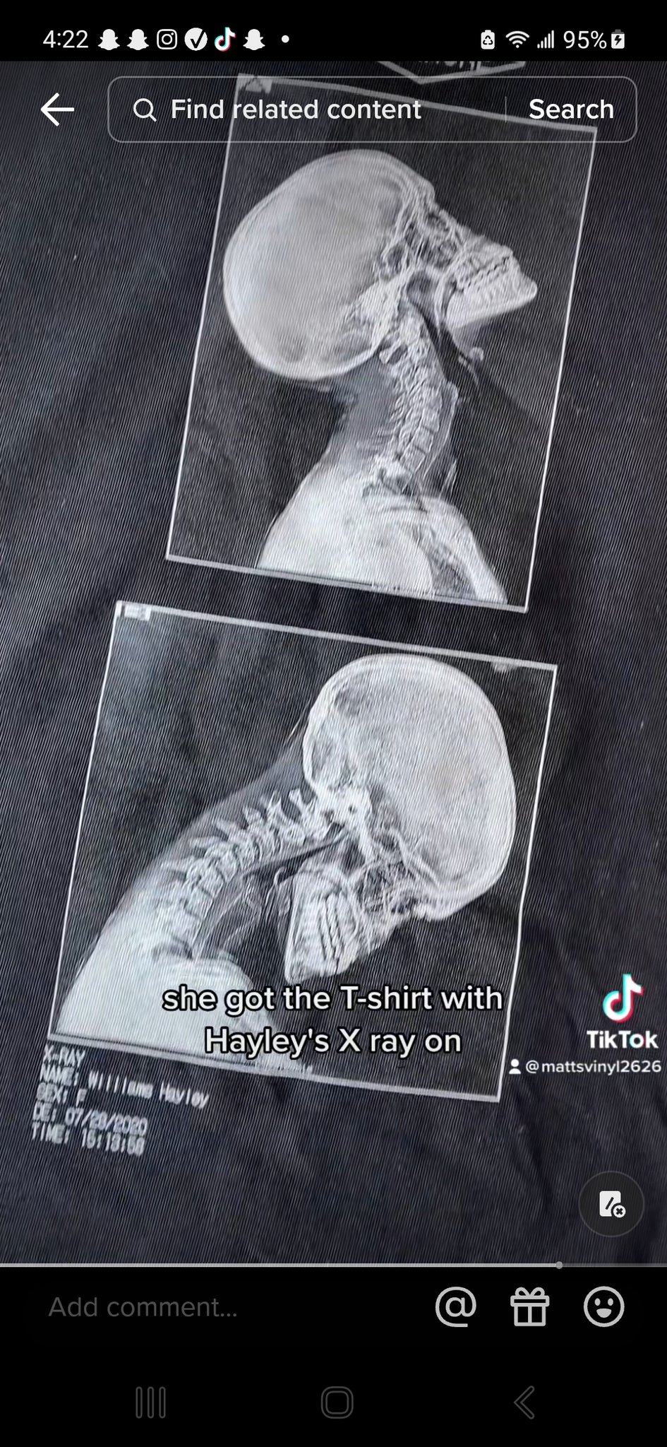 Design 2023 Paramore X Ray Name Williams Hayley Tshirt, 58 OFF