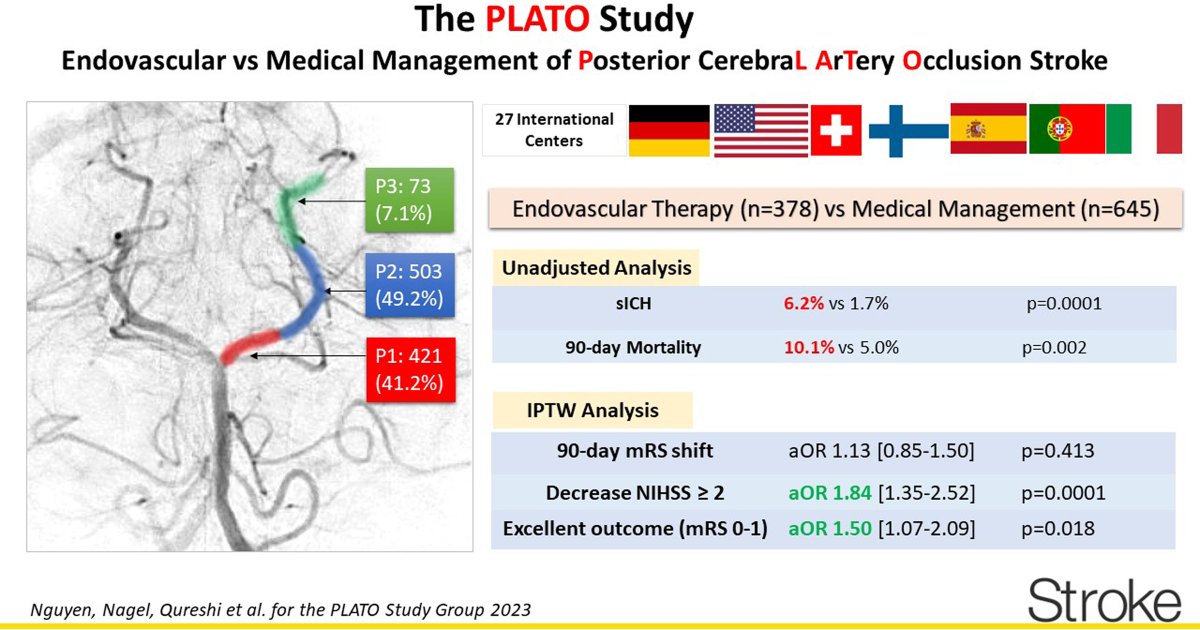 NguyenThanhMD's tweet photo. EVT vs Medical Management of Posterior Cerebral Artery Occlusion: The PLATO Study. Presented at #ESOC2023 by @NagelSimon 

@DStrambo @AbdalkaderMD @MPeyT1  @FishingNeurons @ShadiYaghi2 @Puetz_Volker @daniel_kaiserMD @CheesemakerMD D. Strbian P. Michel  
https://t.co/ZA6jzBJqP1 https://t.co/8h2y4Jv27v