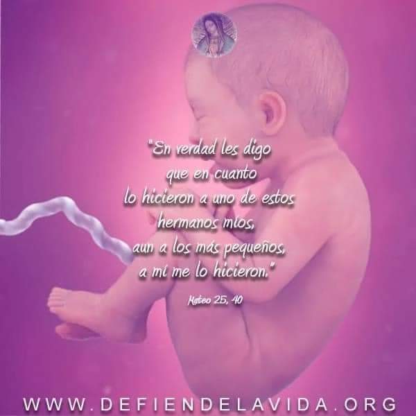 defiendelavida.org
 #SialaVida
 #ParemoselAborto
 #JovenesProVida
 #Inocentes
 #SalvenalosNiños
 #SalvenlosBebes
 #Protegealnonacido
 #DefiendelaVida
 #LaVidaImporta
 #LaVidaesPreciosa
 #OraFinAborto
 #EligelaVida
 #NoNacido
 #ProVida
 #SialaVida
 #Catolico
 #Jesus
 #Amor