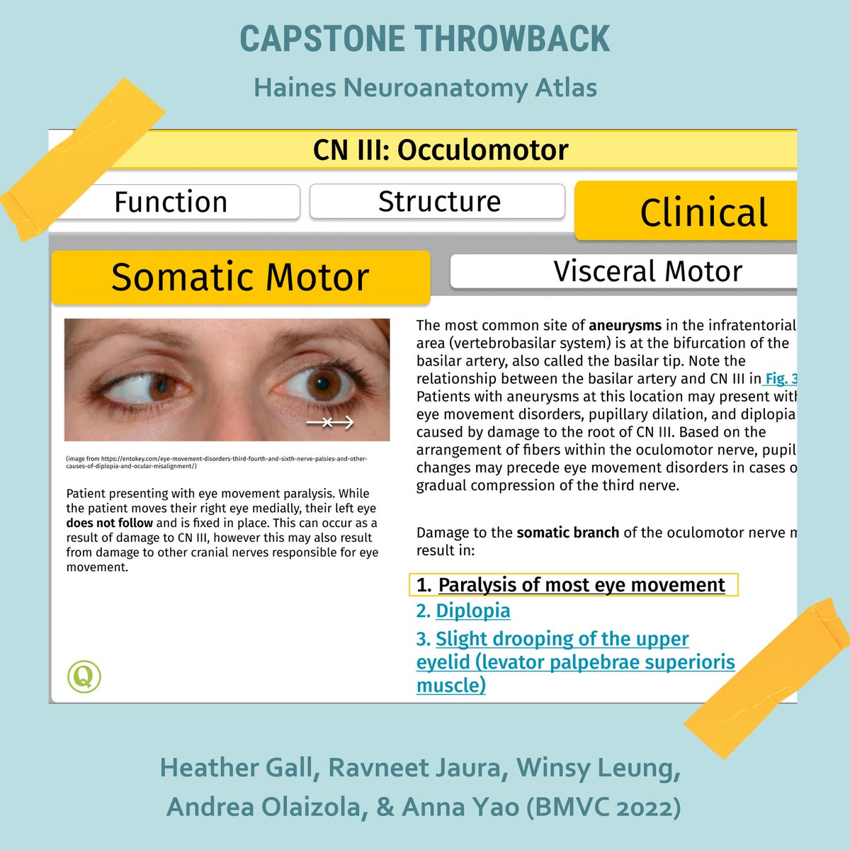 Capstone Project Throwback Day 2: Haines Neuroanatomy Atlas Reimagining  

This team of students worked with an editor at <a href="/wkhealth/">WoltersKluwerHealth</a> to design and prototype an interactive online companion to the Haines Neuroanatomy Atlas using Figma.