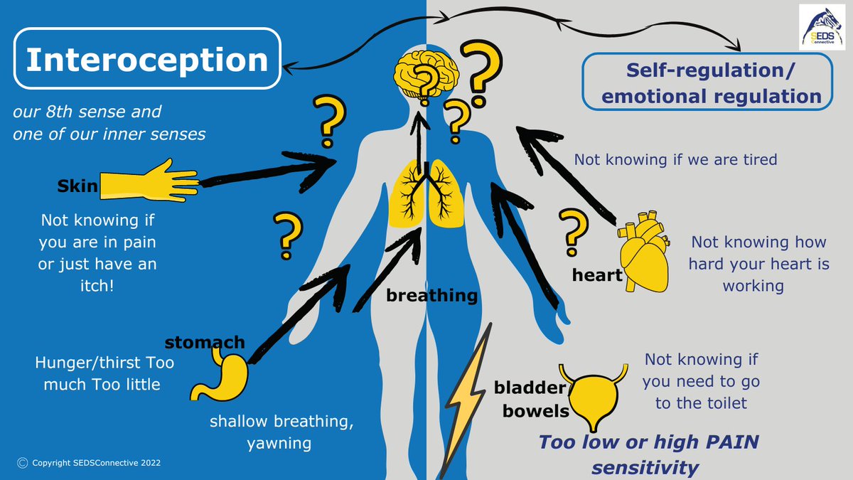 What is interoception? 

Do you have a sense of when you need sleep, need to eat, drink or even when in pain?   

#EDS #HSD #EhlersDanlosSyndromes #HypermobilitySpectrumDisorders  #Neurodivergence #EDSHSDAwarenessMonth  #Interoceoption #Autistm #ADHD #Dyspraxia #MCAS