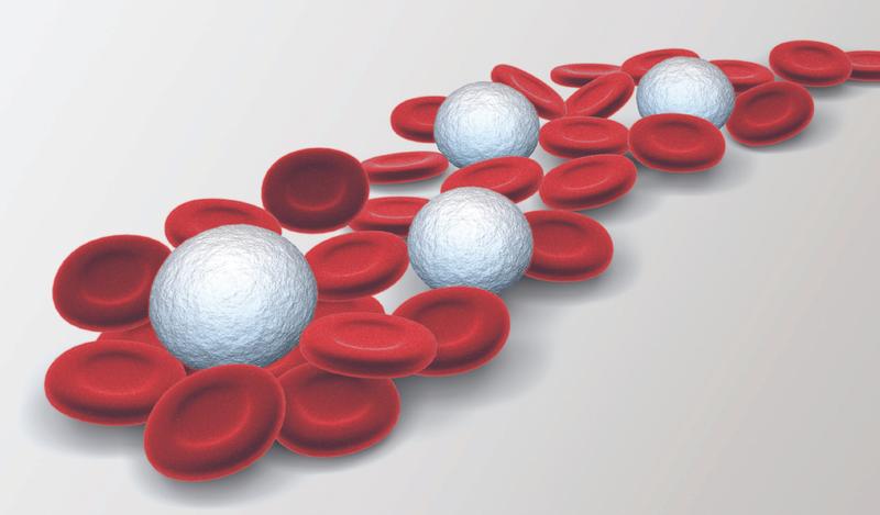 Acquired Von Willebrand Syndrome following a #SARS-CoV2Infection

🔗 ow.ly/HJgY50Owcgf
✍ Michael Iarossi; Cedric Hermans️    @UCLouvain_be 
📖 #ActaHaematol #KargerPublishers