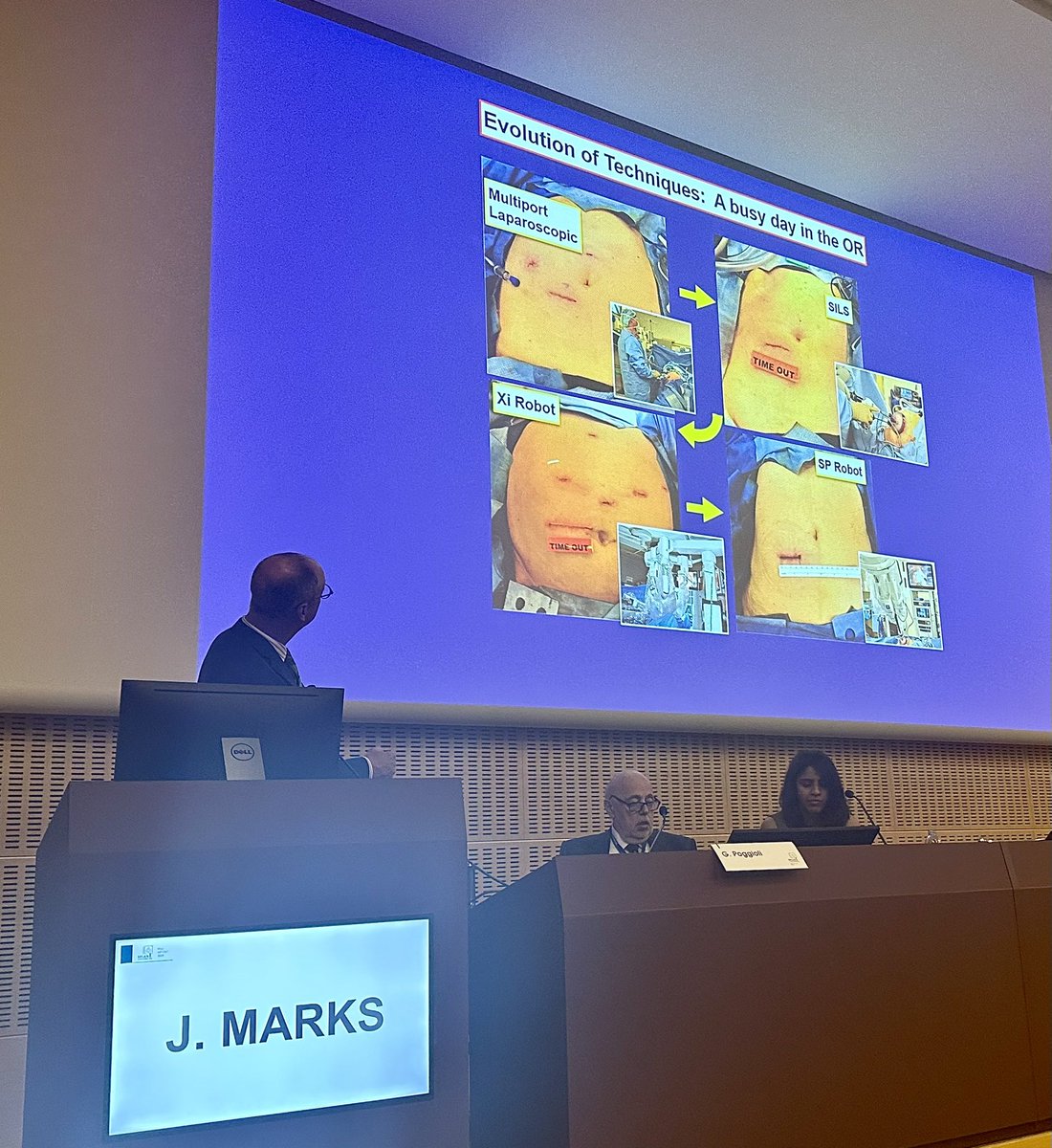 debby_keller's tweet photo. Amazing presentation on SP robotic #colorectalsurgery from @JohnMarksMD @LankenauSurgery @mainlinehealth at #MilanCRS23 @HumanitasCRS https://t.co/DRpRCjTRHl