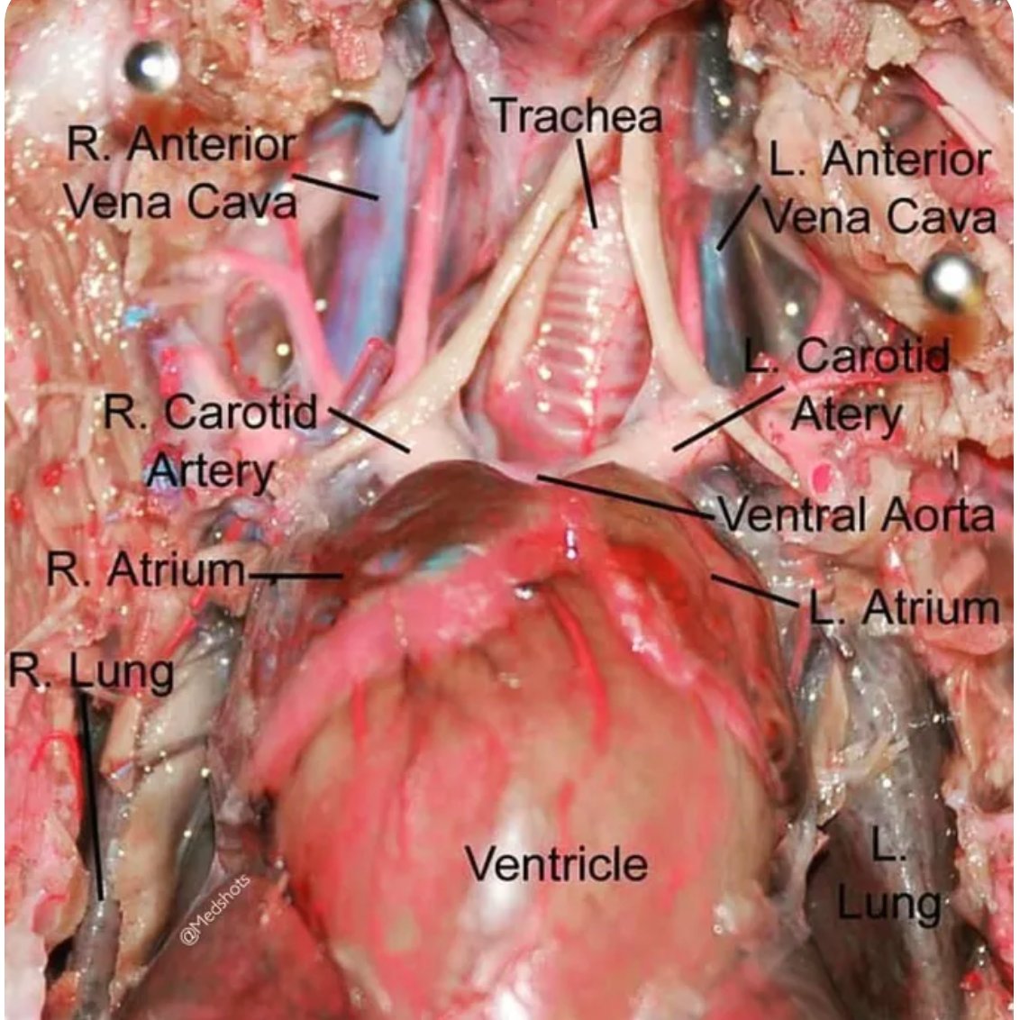 OGdukeneurosurg's tweet photo. Great look at anatomy from medshots https://t.co/k29rAYNBVU