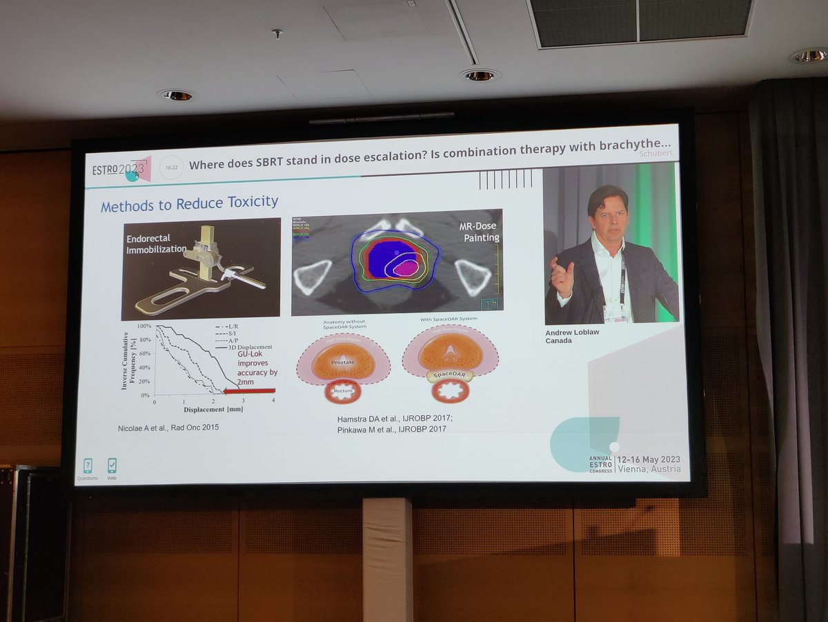 <a href="/DrAndrewLoblaw/">Dr. Andrew Loblaw</a> presents a fantastic Overview of dose escalation in prostate cancer and highlights the extremely important ASCENDE SBRT study which will open later this year.