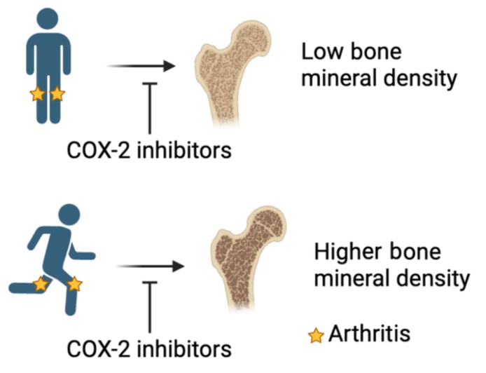 JBMRPlus (@jbmrplus) on Twitter photo A new #JBMRPlus study found that loading prevented arthritis-induced epiphyseal and metaphyseal bone loss, and NS-398 reduced knee swelling without affecting the bone-protective effects of loading #openaccess #freetoread <a href="/suchitadesai22/">Suchita Desai</a> @SWindahl
asbmr.onlinelibrary.wiley.com/doi/full/10.10… A new #JBMRPlus study found that loading prevented arthritis-induced epiphyseal and metaphyseal bone loss, and NS-398 reduced knee swelling without affecting the bone-protective effects of loading #openaccess #freetoread <a href="/suchitadesai22/">Suchita Desai</a> @SWindahl
asbmr.onlinelibrary.wiley.com/doi/full/10.10…