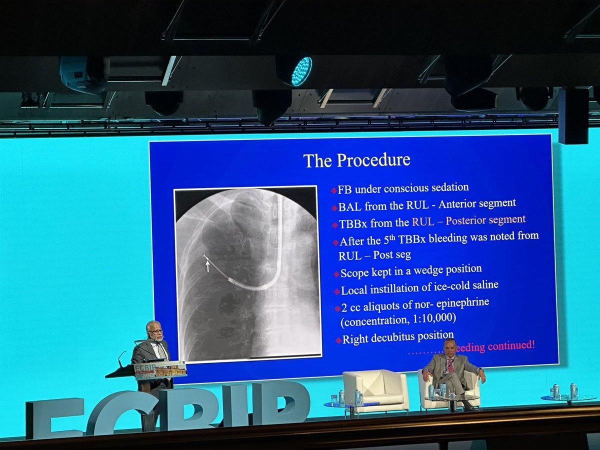 LungConsultant's tweet photo. Dr Atul Mehta @ACM_LTx_Bronch gives a beautiful talk on the legacy he has left to the #bronchoscopy world. 

Immense contribution to TBNA, post transplant stenosis, metal airway stents, laser. Most importantly, the power of learning from complications. 
#ECBIP23 https://t.co/v3TWuGKY0H