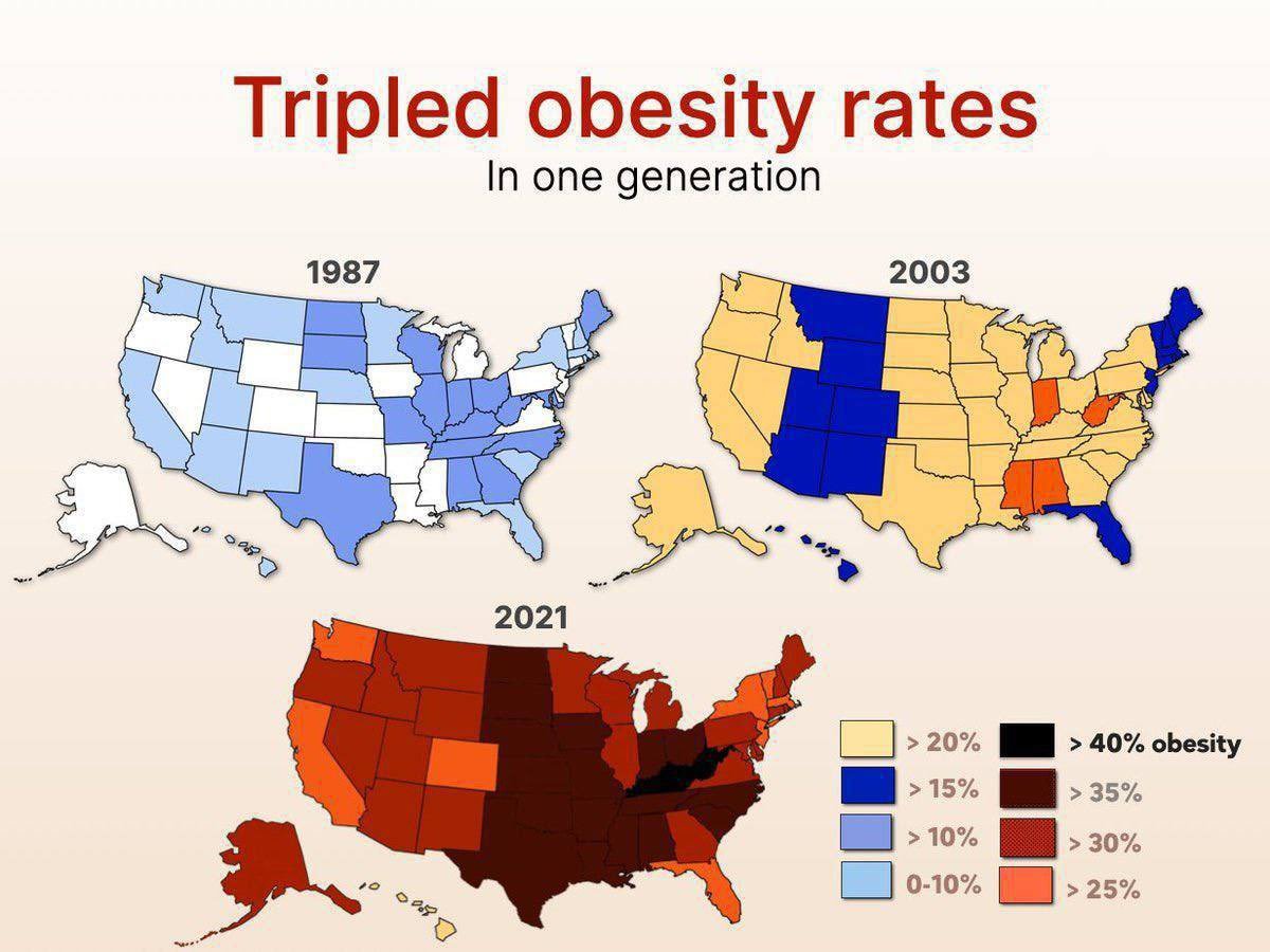 Why did US obesity rates triple in the last 30 years?