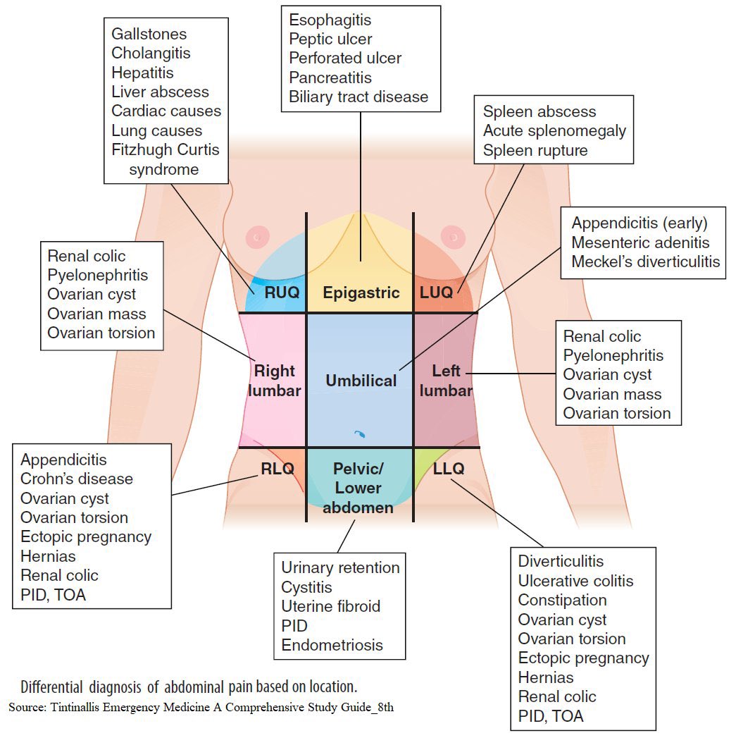 Differential Diagnosis of Abdominal Pain Based on Location h/t <a href="/ManualOMedicine/">Manual Of Medicine</a>
#medtwitter #foamed #meded #USMLE