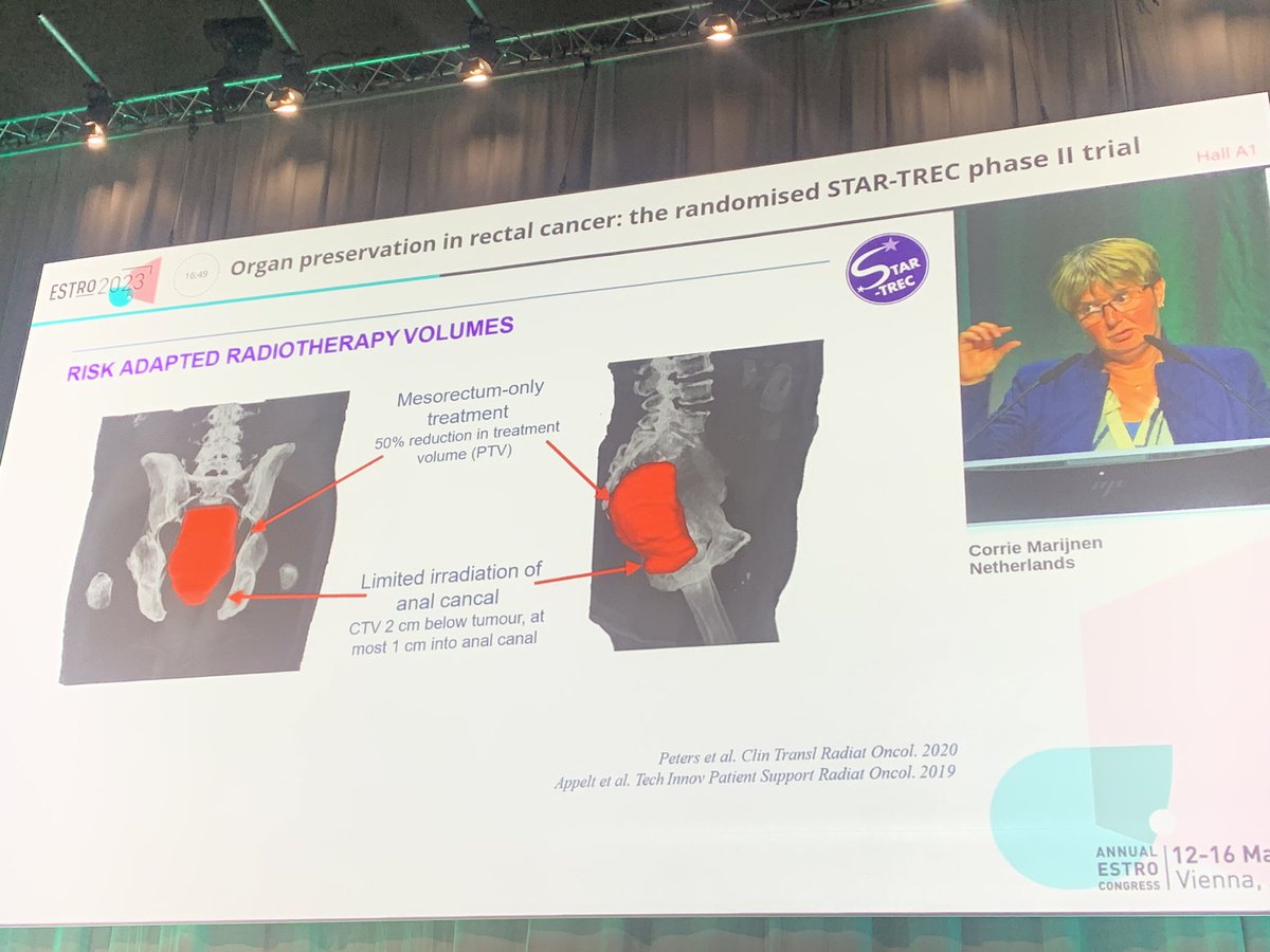 cancerphysicist's tweet photo. It’s always brilliant to see the STAR-TREC phase II data - here expertly presented by Prof Marijnen. Phase III is recruiting very well - with >210 pts randomised in 3 countries to the organ preservation arms #ESTRO2023 #rectalcancer #organpreservation https://t.co/UVI6ZJny30