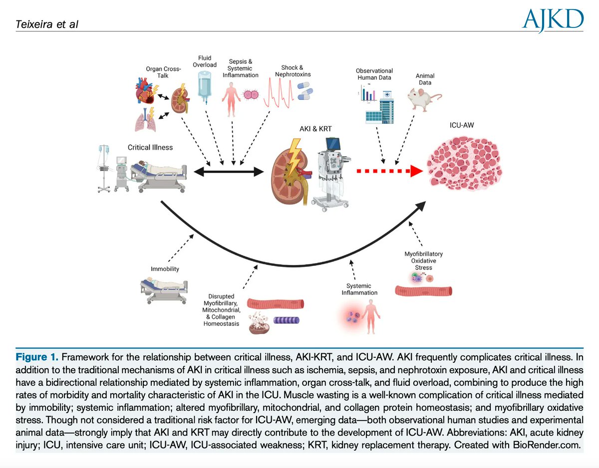 AJKD (@ajkdonline) on Twitter photo Intensive Care Unit–Acquired Weakness in Patients With Acute Kidney Injury: A Contemporary Review
buff.ly/3G8BRTE (FREE)
<a href="/NephCrit_NM/">J Pedro Teixeira (a.k.a. Jwow)</a> @KirbyMayerDPT <a href="/Ben_Griffin_MD/">Ben Griffin</a> <a href="/NRG3000/">Naomi George</a> <a href="/njenkinsphd/">Nathaniel Jenkins, PhD, FAHA</a> <a href="/FGonzalezSeguel/">Felipe González Seguel</a> <a href="/javo_neyra/">Javier Neyra</a> #AKI Intensive Care Unit–Acquired Weakness in Patients With Acute Kidney Injury: A Contemporary Review
buff.ly/3G8BRTE (FREE)
<a href="/NephCrit_NM/">J Pedro Teixeira (a.k.a. Jwow)</a> @KirbyMayerDPT <a href="/Ben_Griffin_MD/">Ben Griffin</a> <a href="/NRG3000/">Naomi George</a> <a href="/njenkinsphd/">Nathaniel Jenkins, PhD, FAHA</a> <a href="/FGonzalezSeguel/">Felipe González Seguel</a> <a href="/javo_neyra/">Javier Neyra</a> #AKI